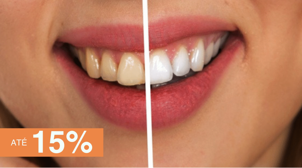 fotos-catalogo-parceiro-s3-implantes-15%-desconto